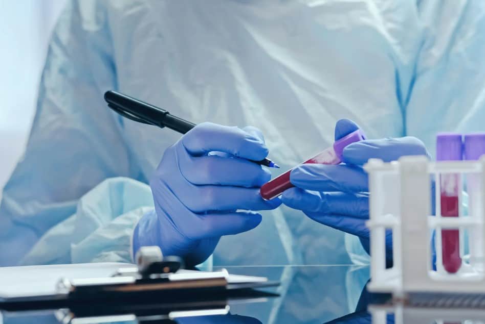 Testovi skrininga koagulacije - Humalab laboratorija Subotica