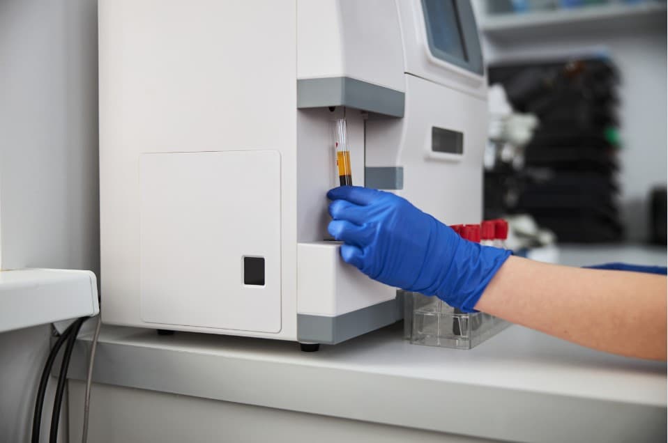 Kako da se pripremite za kompletnu krvnu sliku KKS - vodič Humalab laboratorije Subotica